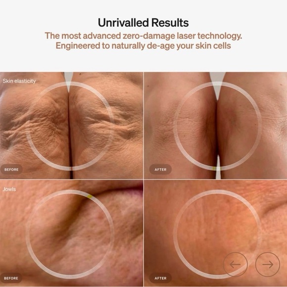 TWO! LYMA LASERS - Picture 7 of 8